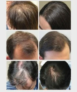 Coupon ⭐ 7Days Ginger Hair Nutrient Solution Haarserum 7days | Haarkuur 7daags | Haaruitval Bestrijden | Gember Extracten Voor Stimuleren Haargroei | Haar Olie | Bewezen Formule 😉 -L'Oréal Shop 550x663